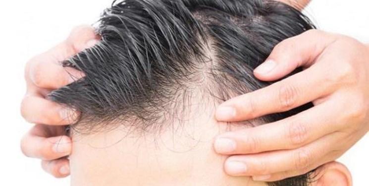 کشف نقش سیستم لنفاوی در رشد موی بدن کشف نقش سیستم لنفاوی در رشد موی بدن