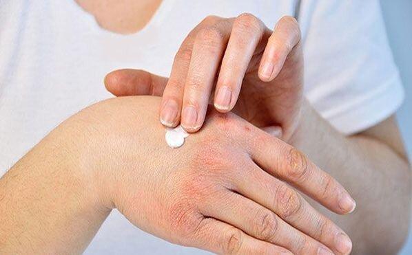پوست خشک و کم آب چه تفاوتی با یکدیگر دارند؟